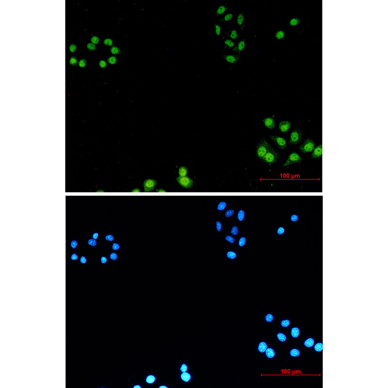AKAP95 Rabbit mAb